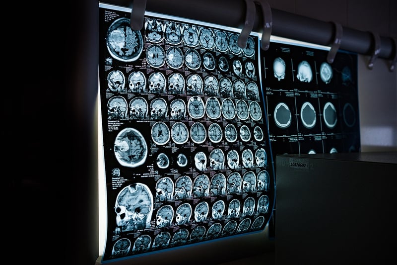 Mindfulness Body Scan